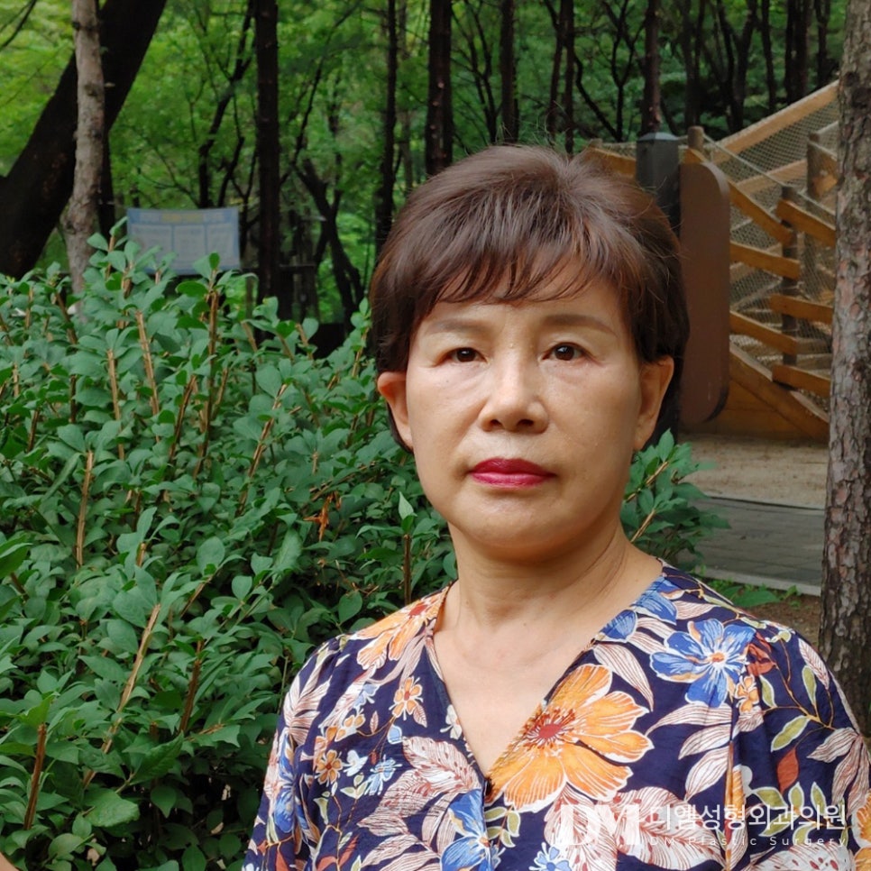 안면거상, 다시 젊었던 나로 ! 관련 이미지 1