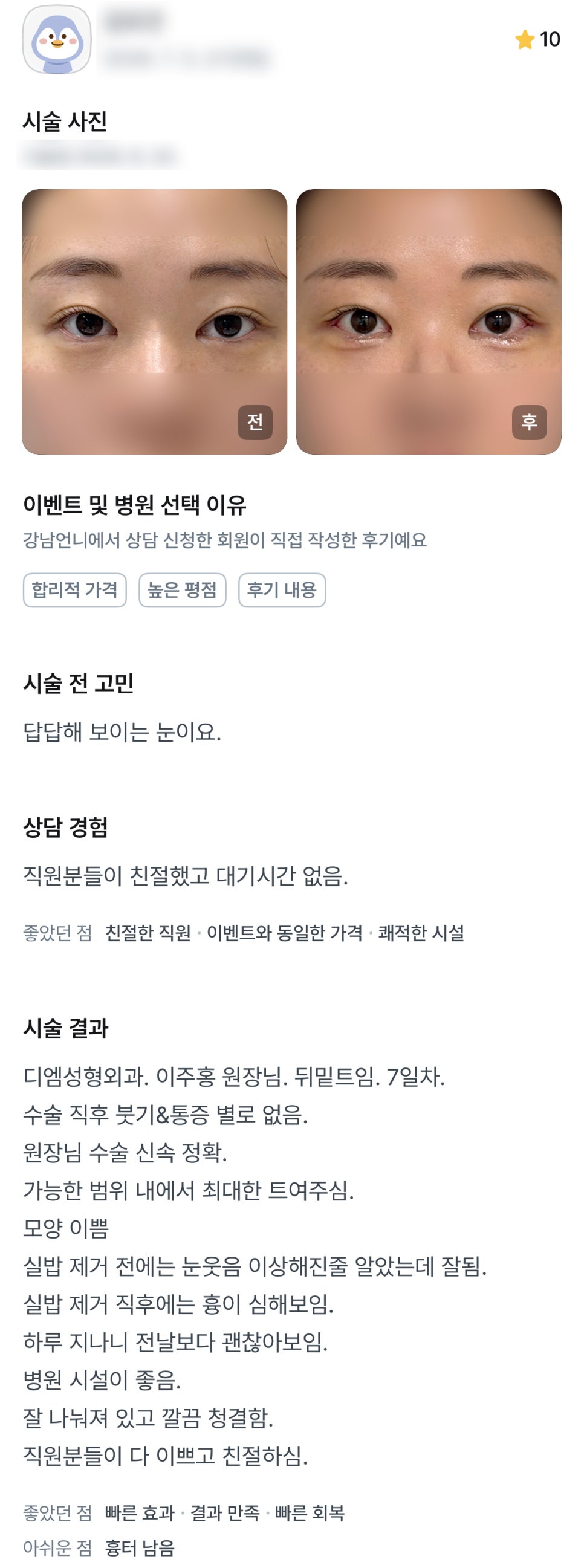 디엠 뒤밑트임 수술후기, “가능한 범위 내에서 최대한 트여주세요!” 관련 이미지 1