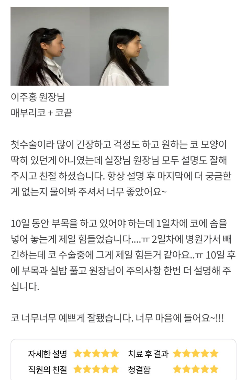 코성형 후기."코 너무너무 예쁘게 잘 됐습니다. 너무 마음에 들어요 ~!!!" 관련 이미지 1