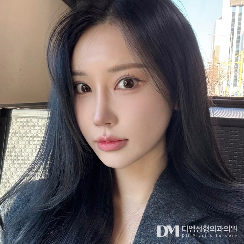 디엠 빵트임 전후사진, 가로로 길어진 시원한 눈매의 비밀 관련 이미지 3