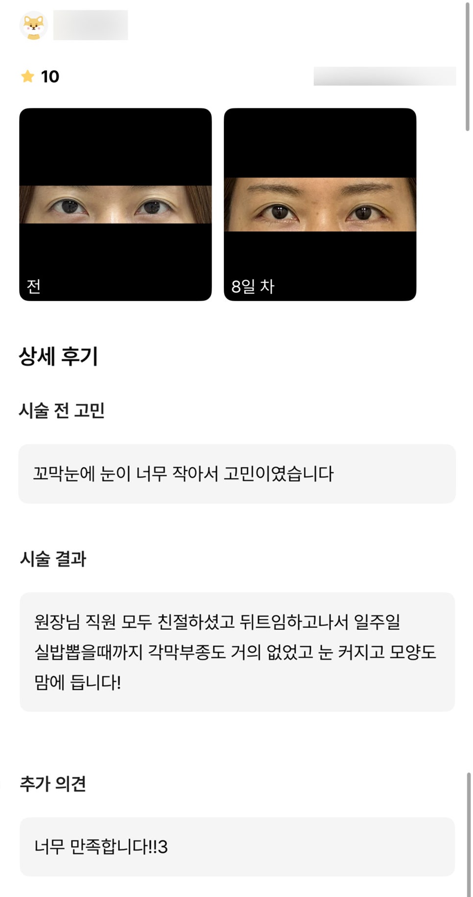 뒤밑트임 후기." 눈 커지고 모양도 맘에 들어 너무 만족합니다 !!!" 관련 이미지 1