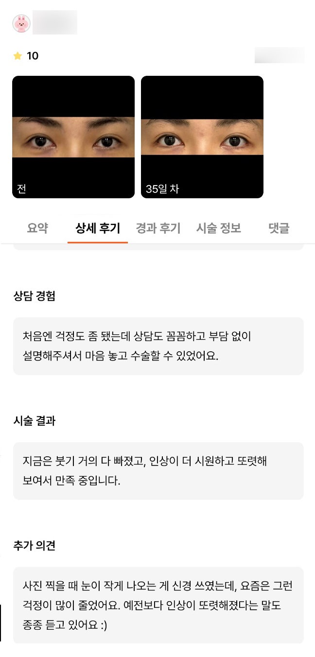 빵트임 후기."인상이 더 시원하고 또렷해보여서 만족 중입니다" 관련 이미지 1