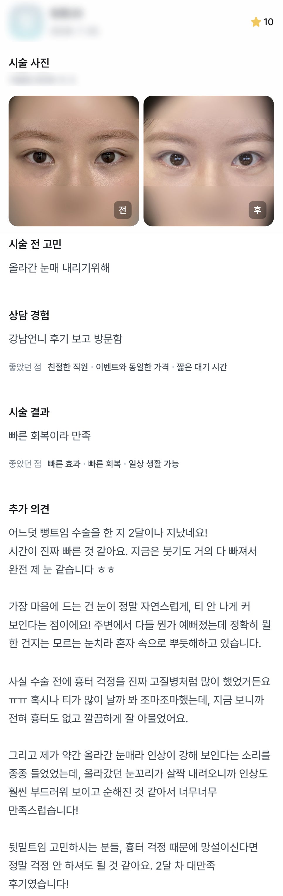 디엠 뒤밑트임 수술후기, “인상이 훨씬 부드러워 보여서 너무 만족스러워요!” 관련 이미지 1