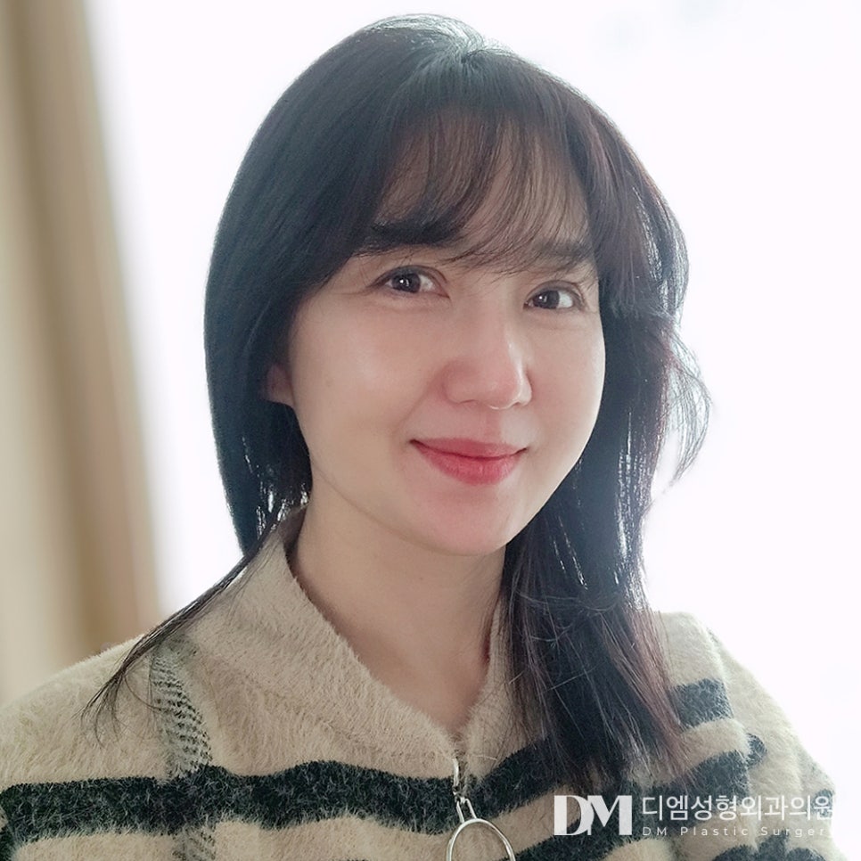 DM Facelift Before-and-After Photos: A Noticeably Changed Jawline at a Glance image 1