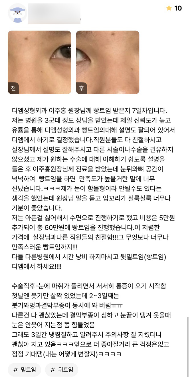 빵트임 후기."다들 다른 병원에서 시간 낭비 하지 마시고 디엠에서 하세요!!!!" 관련 이미지 1