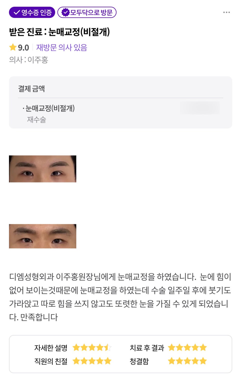 Blepharoplasty Review. "I’m satisfied that I can have clear eyes without having to strain them separately." image 1