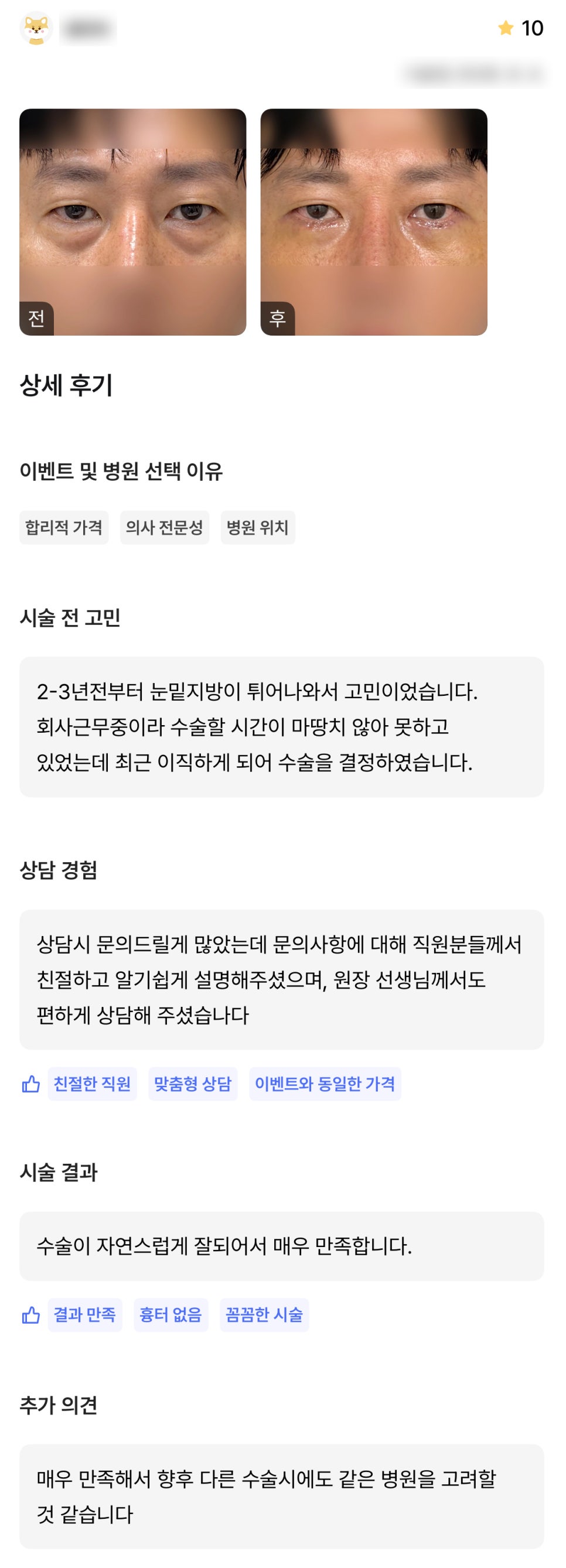 DM Lower Eyelid Surgery Review, “It turned out so naturally, and I’m very satisfied!” image 1