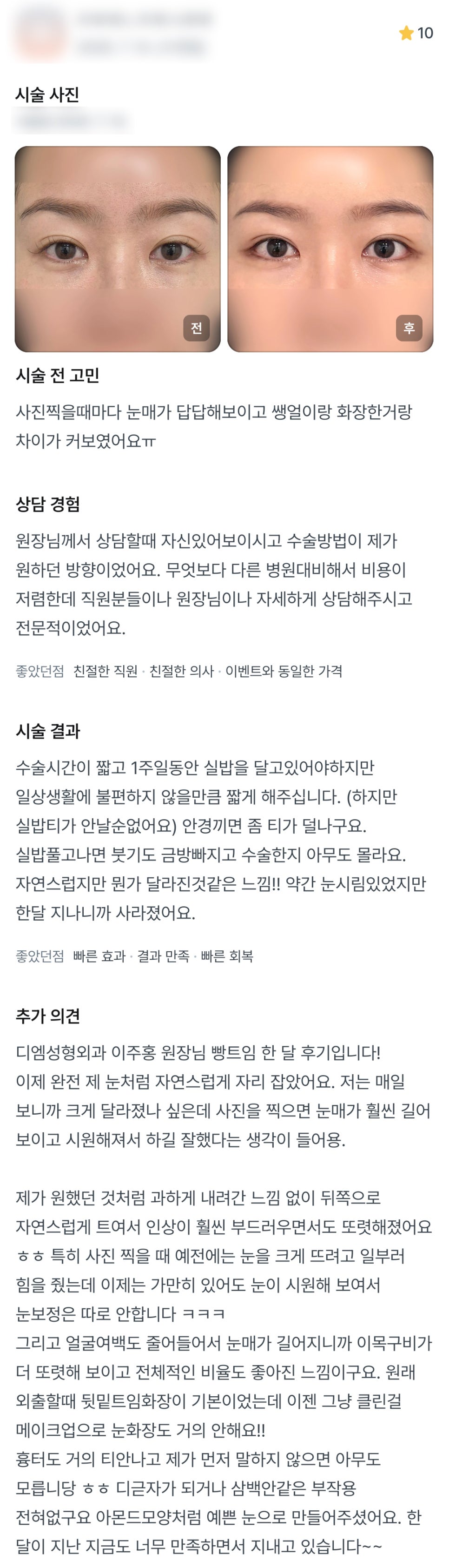 디엠 빵트임/트임성형 후기, &ldquo;눈매가 훨씬 길어 보이고 시원해져서 하길 잘했다는 생각이 들어요!&rdquo; 관련 이미지 1