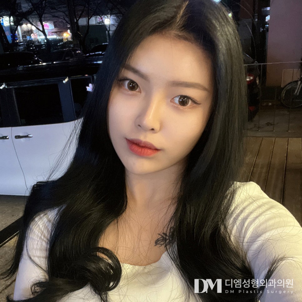 겹주름이 져 피곤한 인상으로 보인다면? 관련 이미지 1