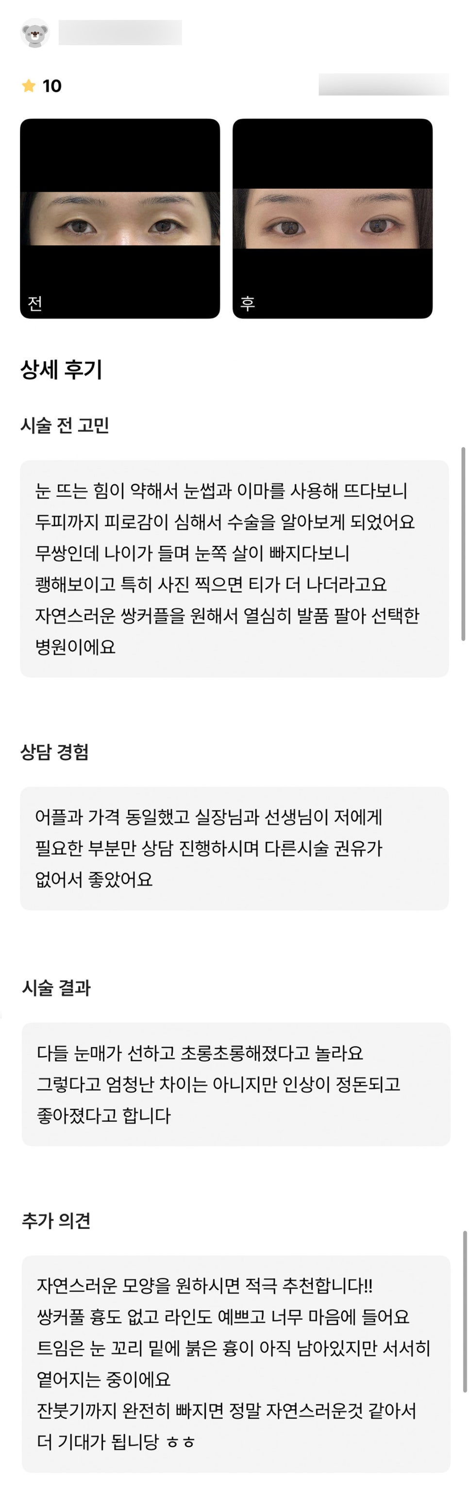 Eye Surgery Review. “Everyone says my eye shape looks gentle and bright now!” image 1