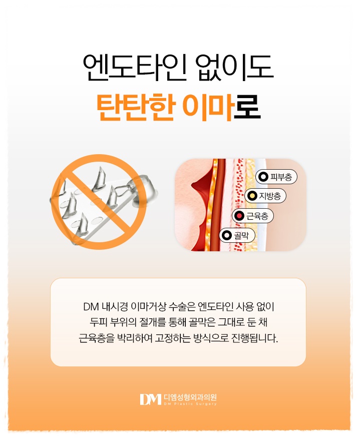 이마거상, 이마 주름과 처진 눈매를 한번에 교정하고 싶다면? 관련 이미지 3