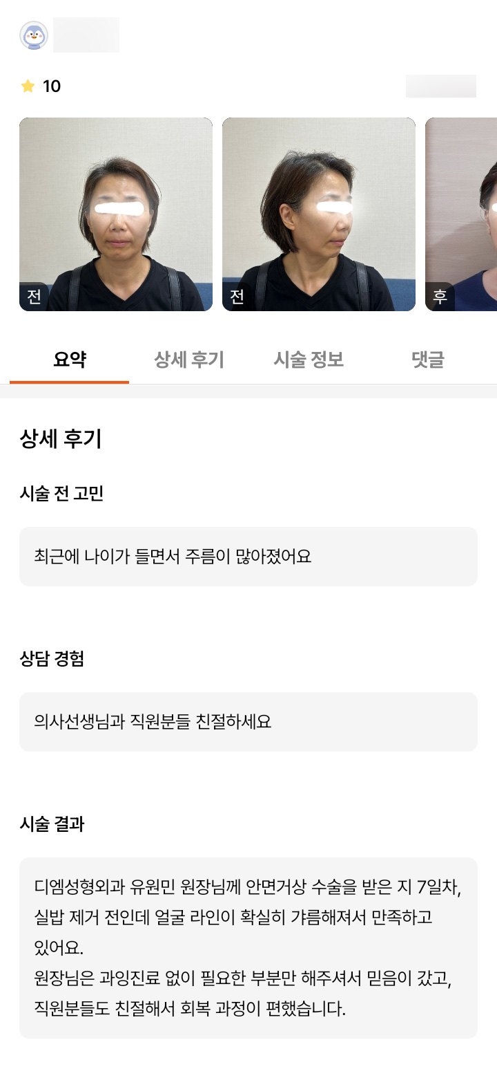 안면거상 후기."얼굴 라인이 확실히 갸름해져서 만족하고 있어요." 관련 이미지 1