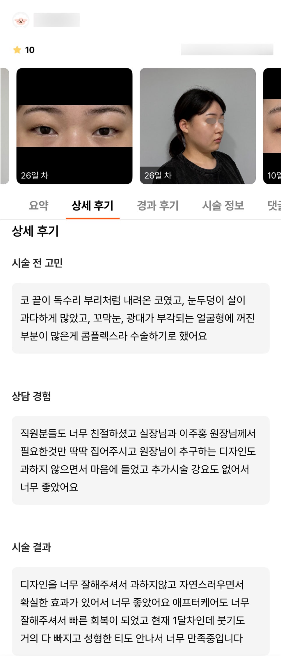 코성형 후기."붓기도 거의 다 빠지고 성형한티도 안나서 너무 만족중입니다" 관련 이미지 1