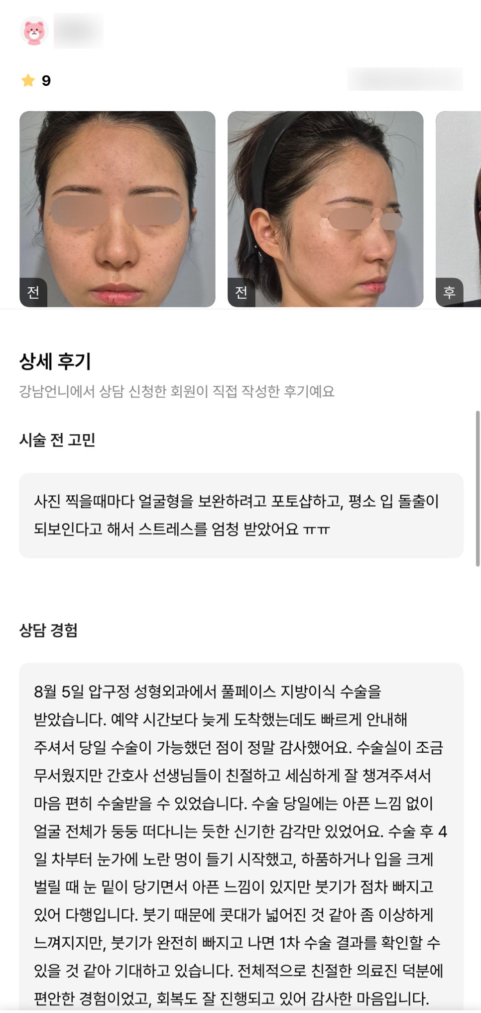 얼굴지방이식 후기."전체적으로 친절한 의료진 덕분에 편안한 경험이었고, 회복도 잘 진행되고 있어 감사한 마음입니다." 관련 이미지 1