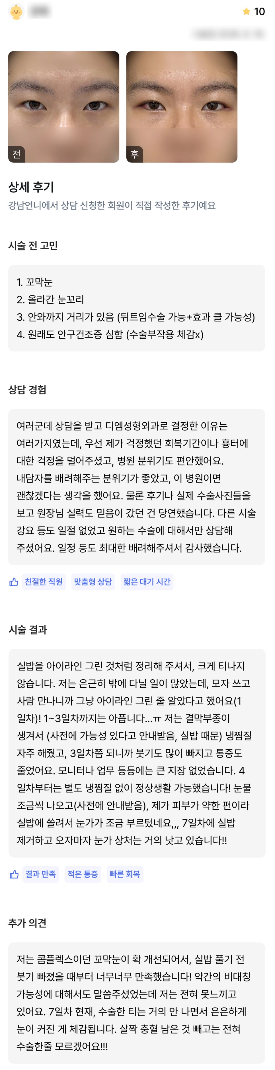 디엠 뒤밑트임 수술후기, “꼬막눈이 확 개선되어서 너무너무 만족해요!” 관련 이미지 1