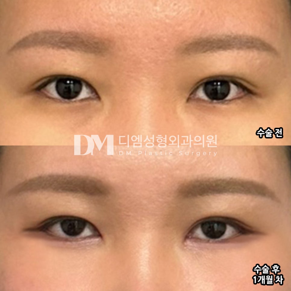 Bbangteim Review. "I’m satisfied because it looks completely natural!" image 2