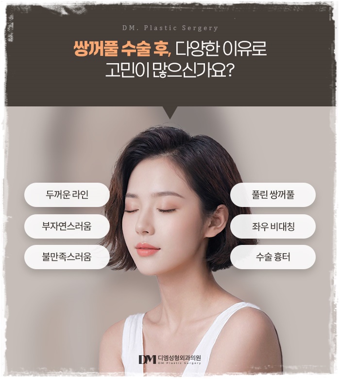 눈재수술, 쌍꺼풀이 풀려 비대칭 눈매가 되었다면? 관련 이미지 3