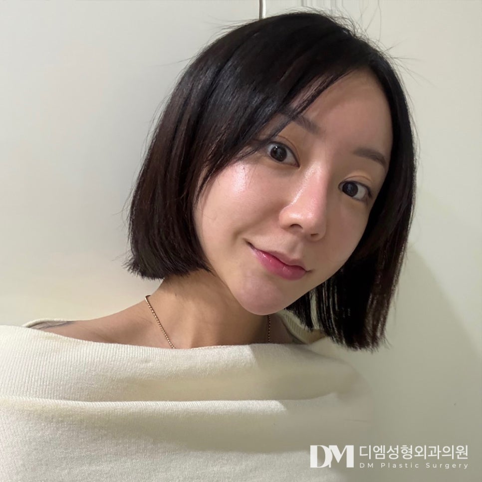 반거상, 안면거상은 부담스러웠다면 주목! 관련 이미지 1