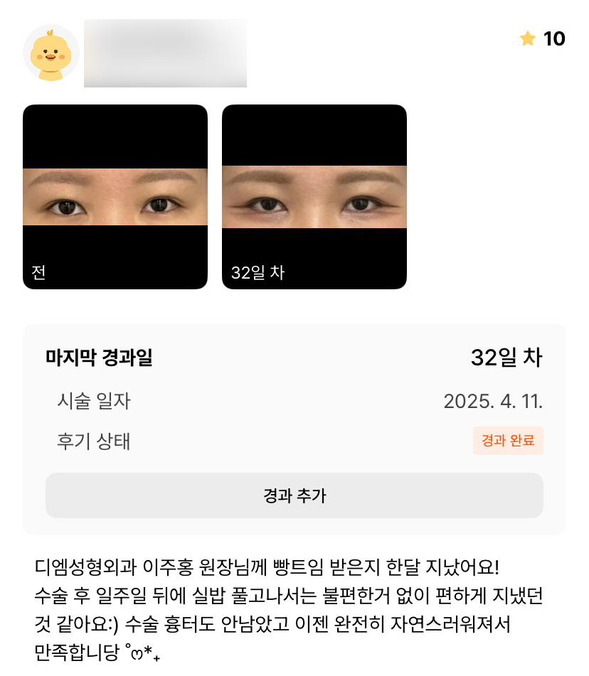 Bbangteim Review. "I’m satisfied because it looks completely natural!" image 1