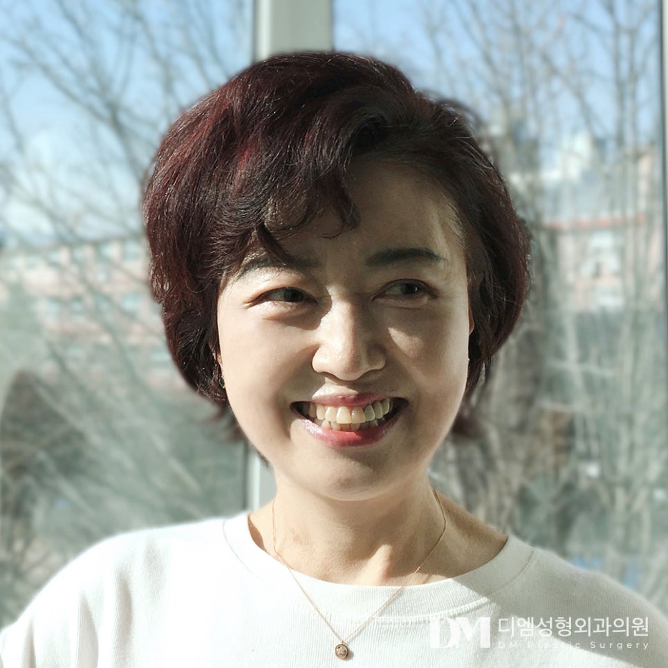 하안검, 눈 밑 노화가 고민이라면? 관련 이미지 1