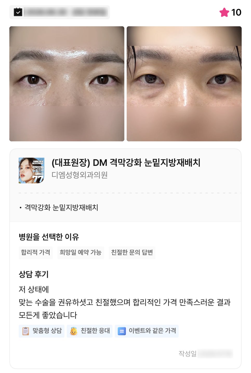 디엠 눈밑지방재배치 수술후기, “가격, 결과 모든 게 좋았습니다!” 관련 이미지 1