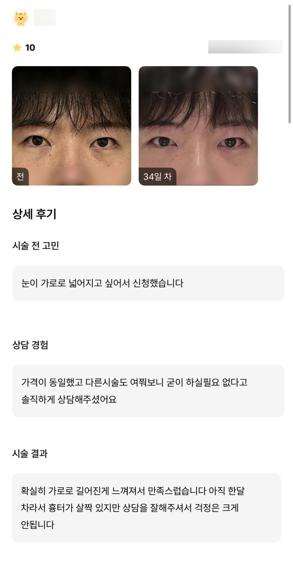 뒤밑트임 후기."확실히 가로로 길어진 게 느껴져서 만족스럽습니다." 관련 이미지 1