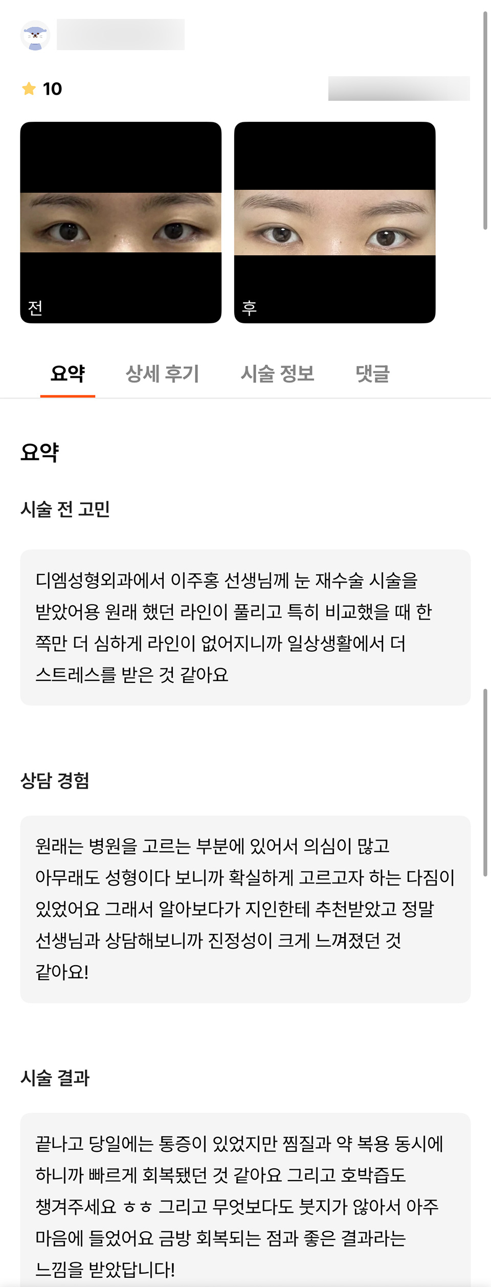 Eyelid Revision Surgery Review. "I liked the sincerity of the director, and I am also satisfied with the results!" image 1