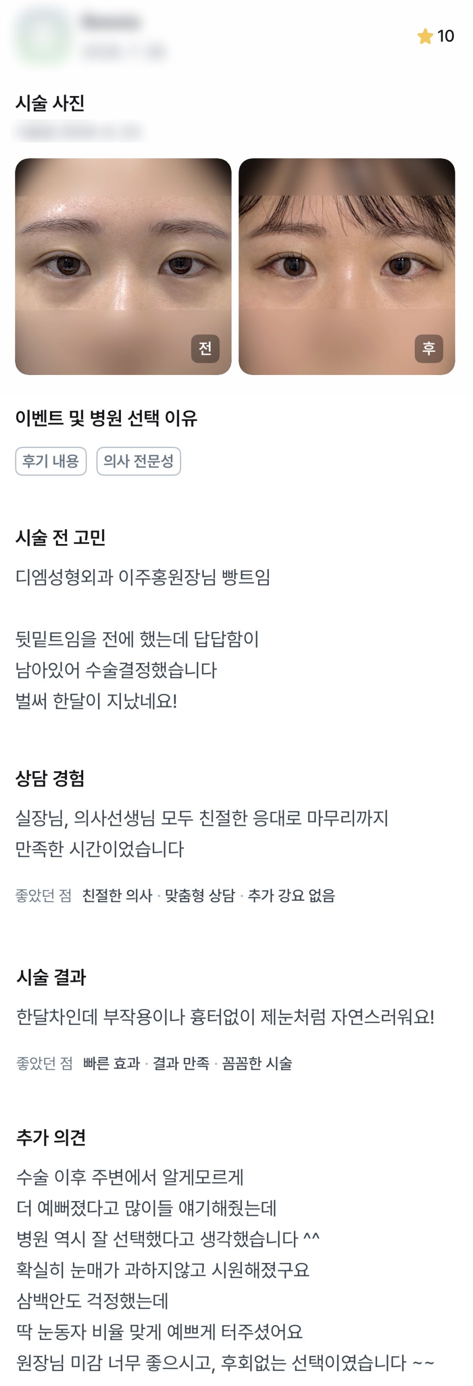 디엠 트임재수술 후기, “흉터 없이 제 눈처럼 자연스러워요! 후회 없는 선택!” 관련 이미지 1