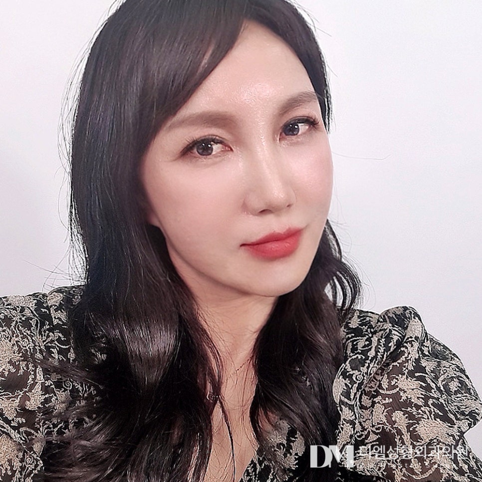 안면거상, 자연스럽게 동안으로 변신하기 ! 관련 이미지 16