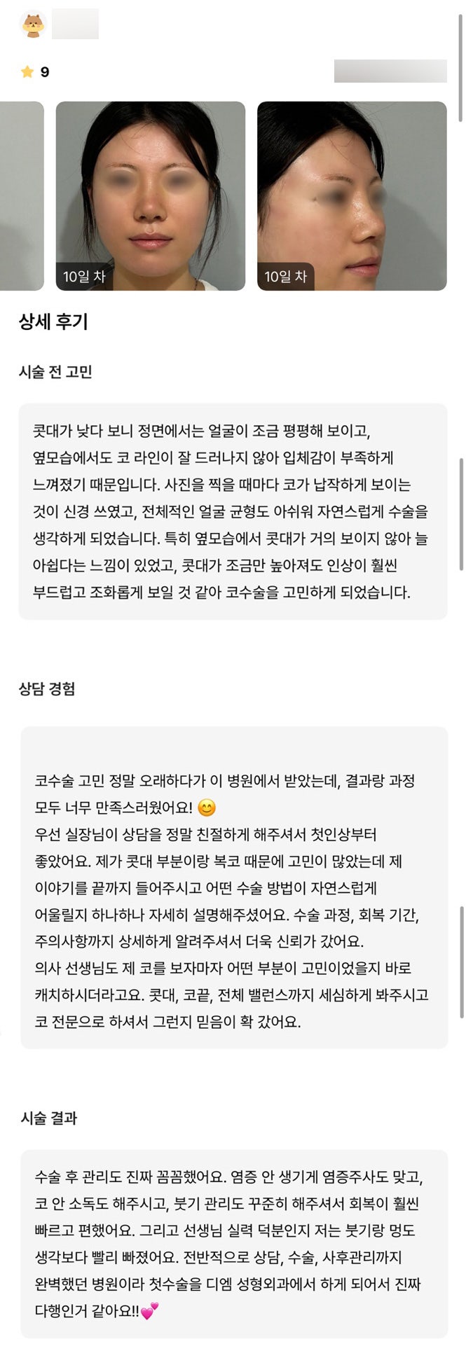 코성형 후기."콧대,코끝, 전체 밸런스까지 세심하게 봐주시고 코 전문으로 하셔서 그런지 믿음이 확 갔어요." 관련 이미지 1