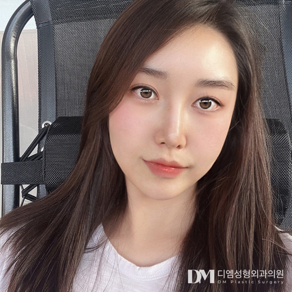 눈매교정, 피곤해보이는 인상 탈출하기 관련 이미지 1