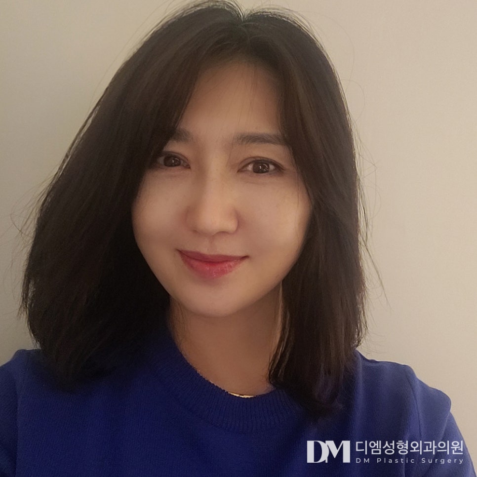 디엠 안면거상 전후사진, 거울 보기 속상했던 날들은 안녕! 관련 이미지 3