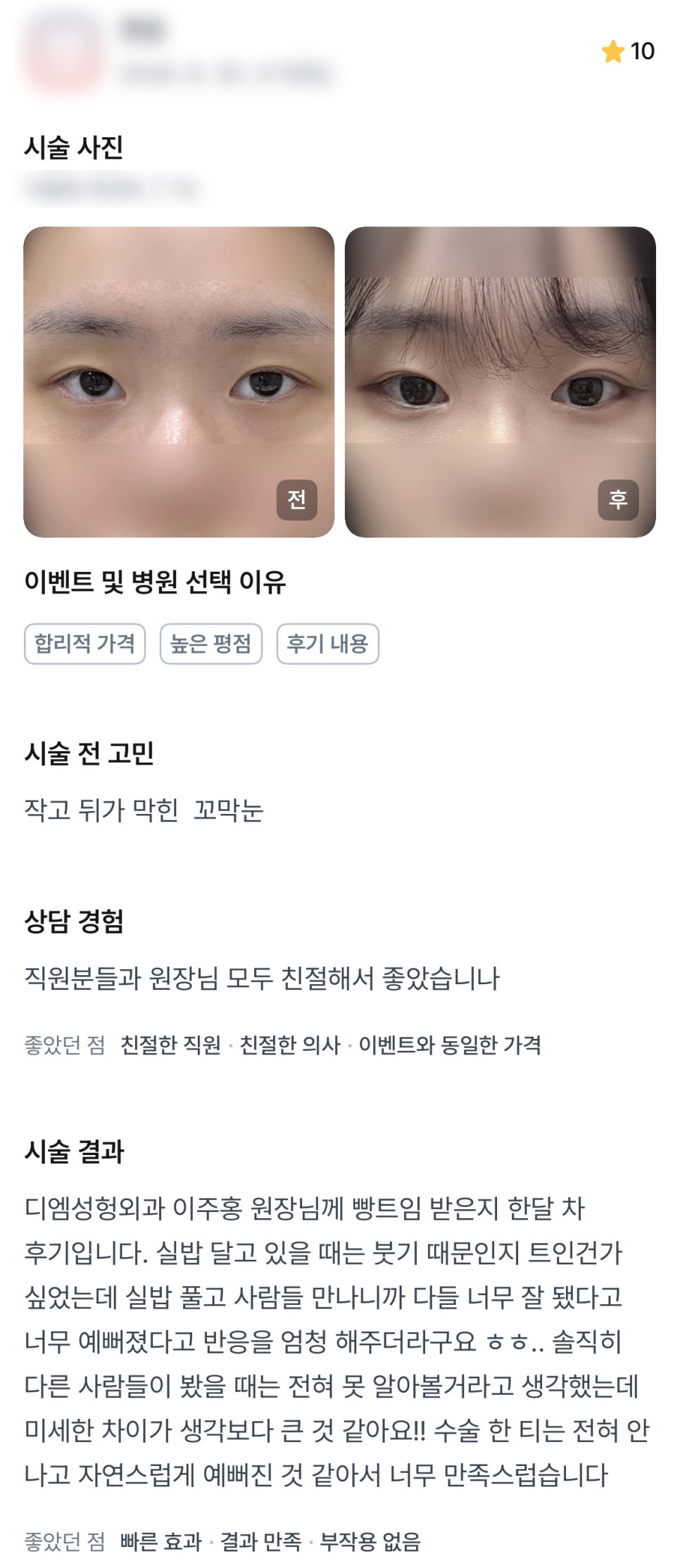 디엠 뒤밑트임/트임성형 후기, “자연스럽게 예뻐진 것 같아서 너무 만족스러워요!” 관련 이미지 1