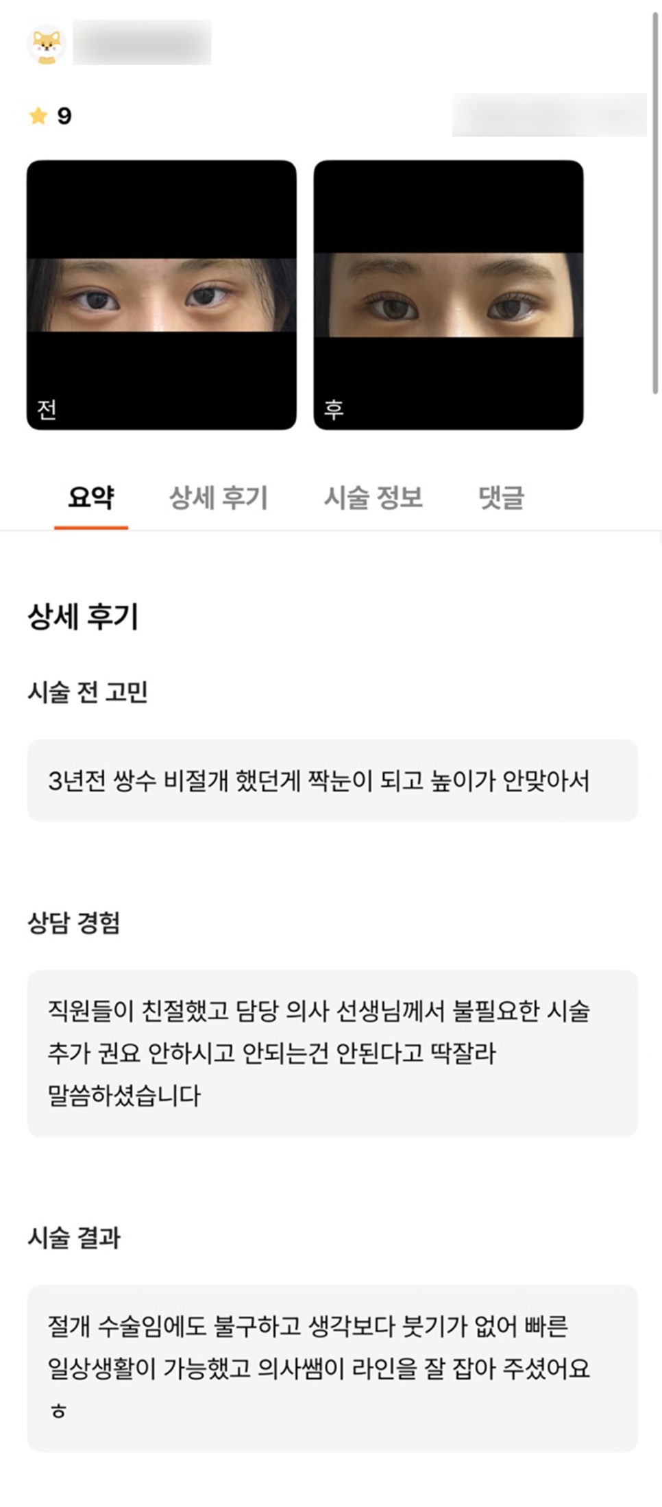 Double Eyelid Revision Surgery Review. "The director defined the line well, and there was little swelling, so I was able to return to daily life quickly, which I liked!" image 1