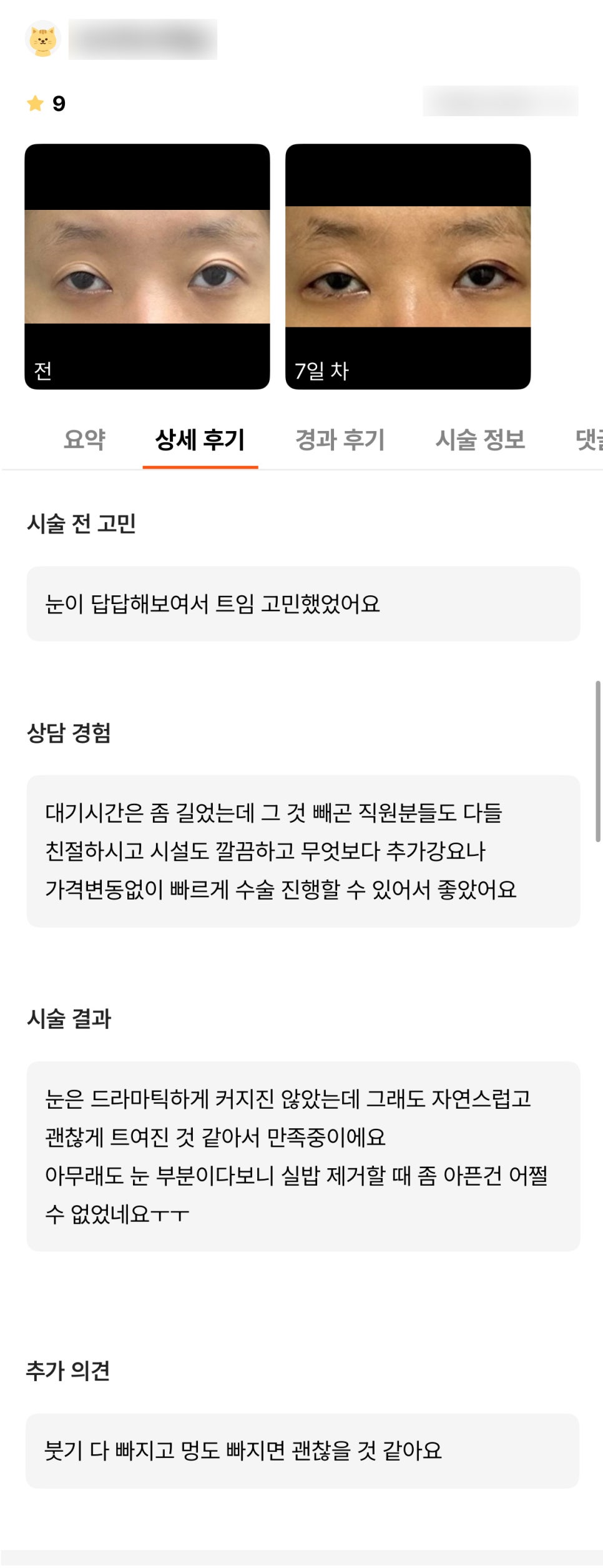Corner Eye Surgery Review. "I'm satisfied because it seems to have opened up naturally and nicely!" image 1