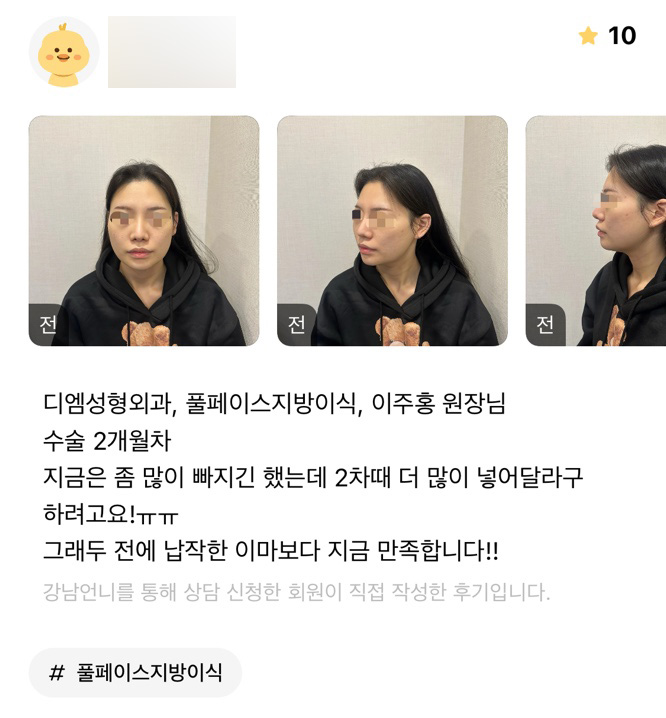 얼굴지방이식 후기."납작했던 이마일때보다 지금 더 만족합니다!" 관련 이미지 1