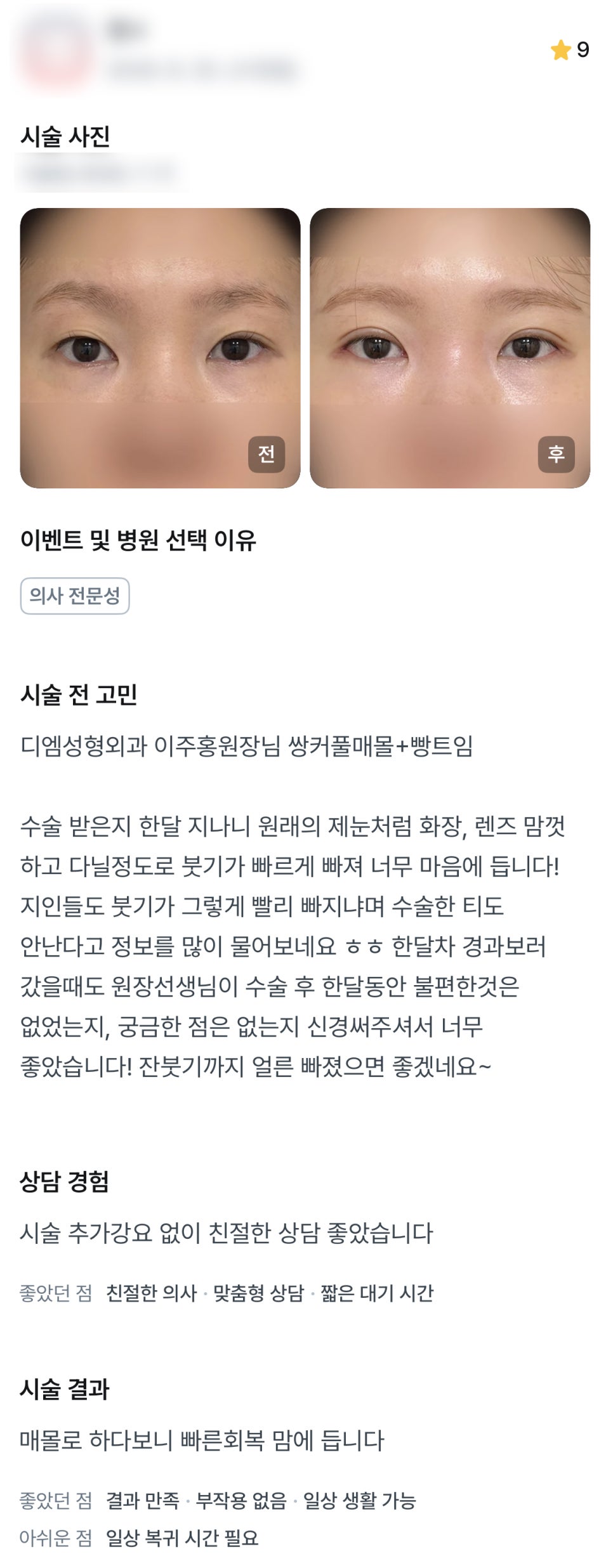 디엠 눈재수술/뒤밑트임 후기, &ldquo;붓기가 빠르게 빠져 너무 마음에 듭니다!&rdquo; 관련 이미지 1