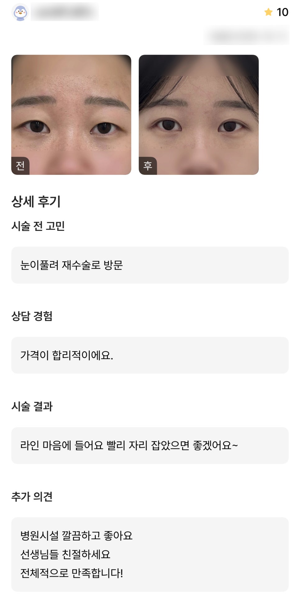 디엠 눈재수술/빵트임 수술후기, “전체적으로 만족합니다!” 관련 이미지 1