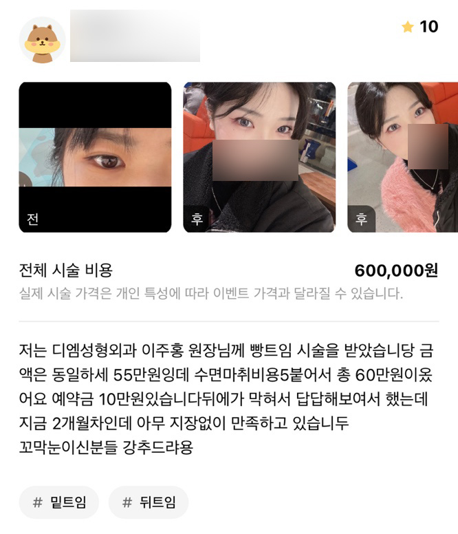 빵트임 후기."꼬막눈이신분들 강추드려용!!" 관련 이미지 1
