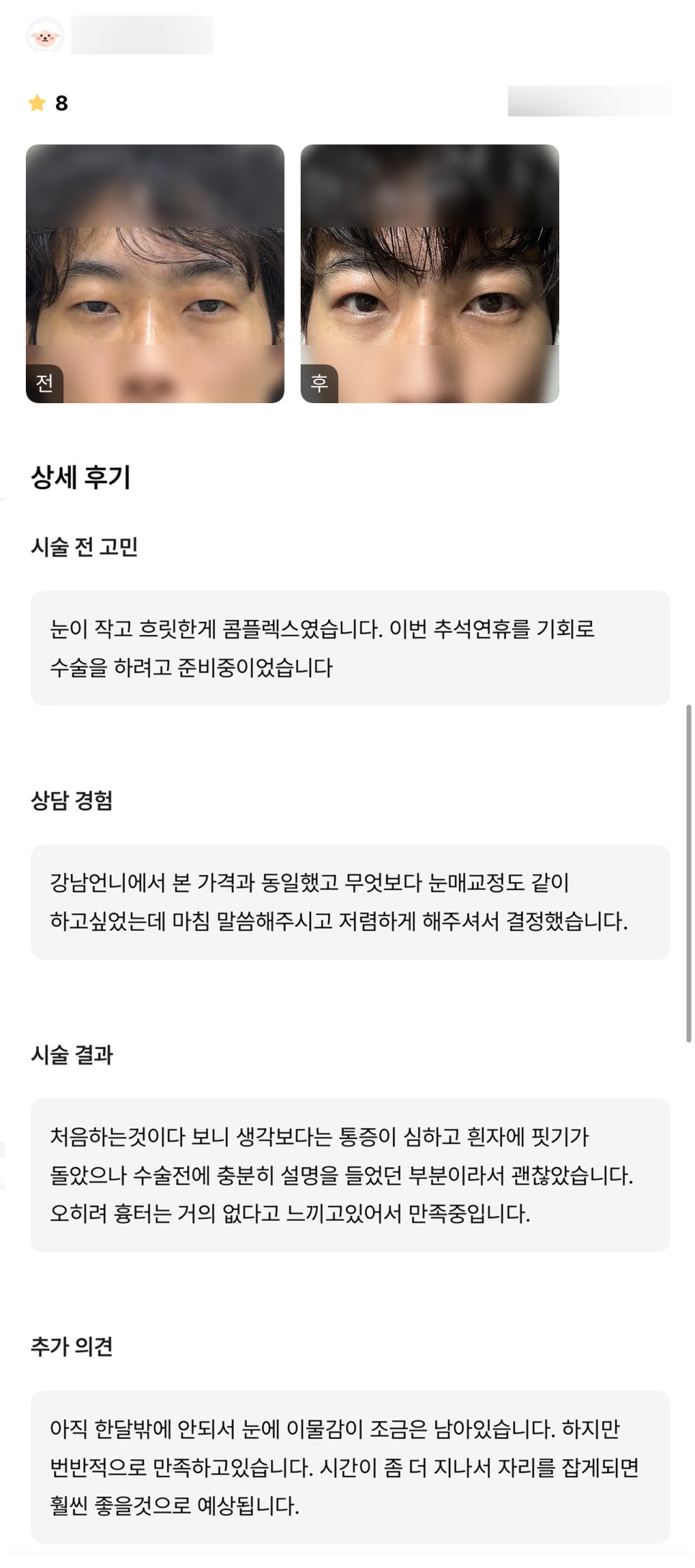 눈성형 후기."전반적으로 만족하고 있습니다!" 관련 이미지 1