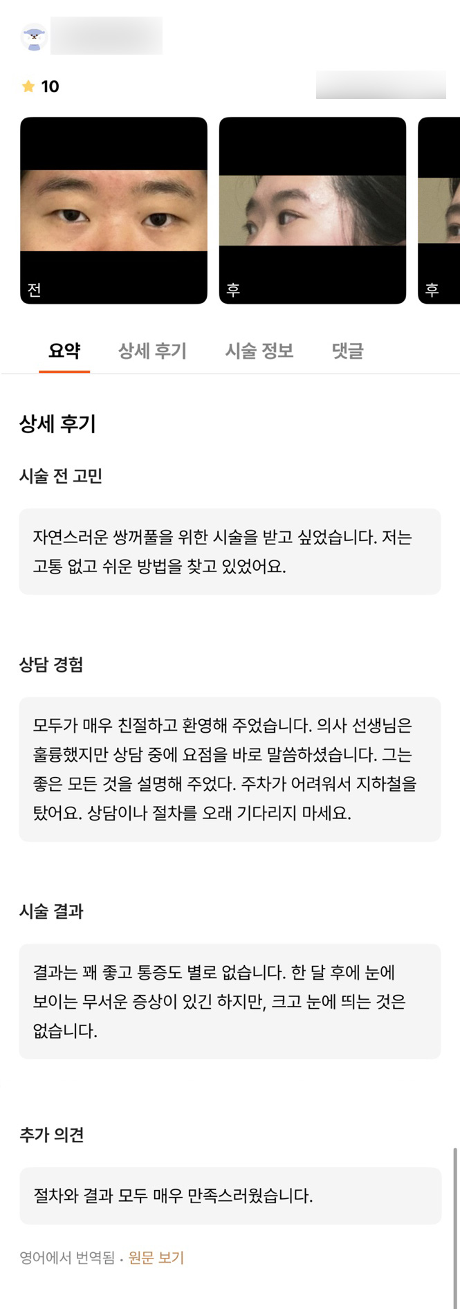 Eye Surgery Review. "I’m happy with both the procedure and the results!" image 1
