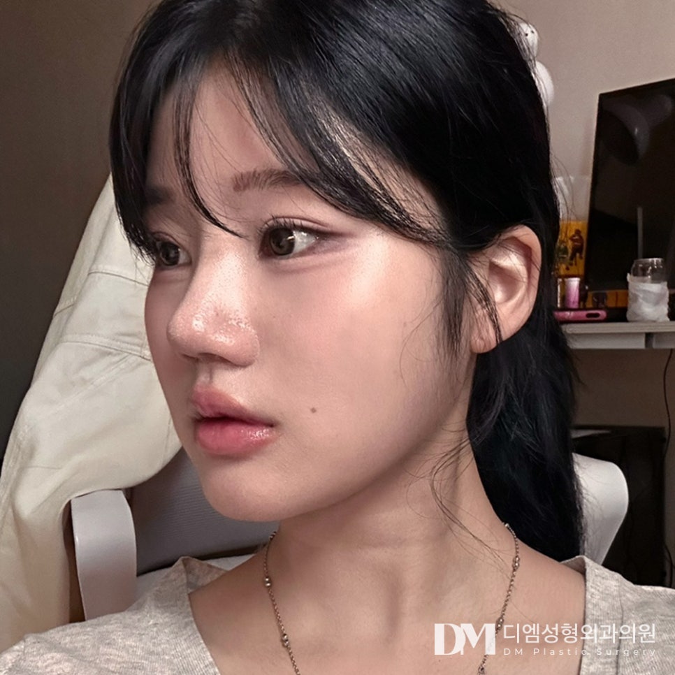 나에게 맞는 높이를 찾아주는 맞춤형 낮은코성형 관련 이미지 11