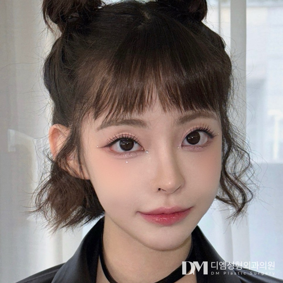 눈밑지방재배치, 칙칙하고 피곤해보이는 인상을 개선하려면?! 관련 이미지 11