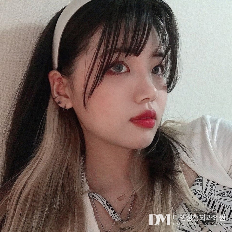 낮은코성형 , 만족도 높이려면? 관련 이미지 1
