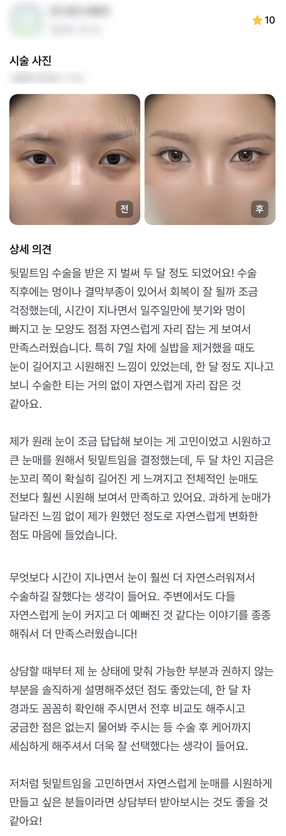 디엠 뒤밑트임/트임성형 후기, &ldquo;수술하길 잘했다는 생각이 들어요!&rdquo; 관련 이미지 1