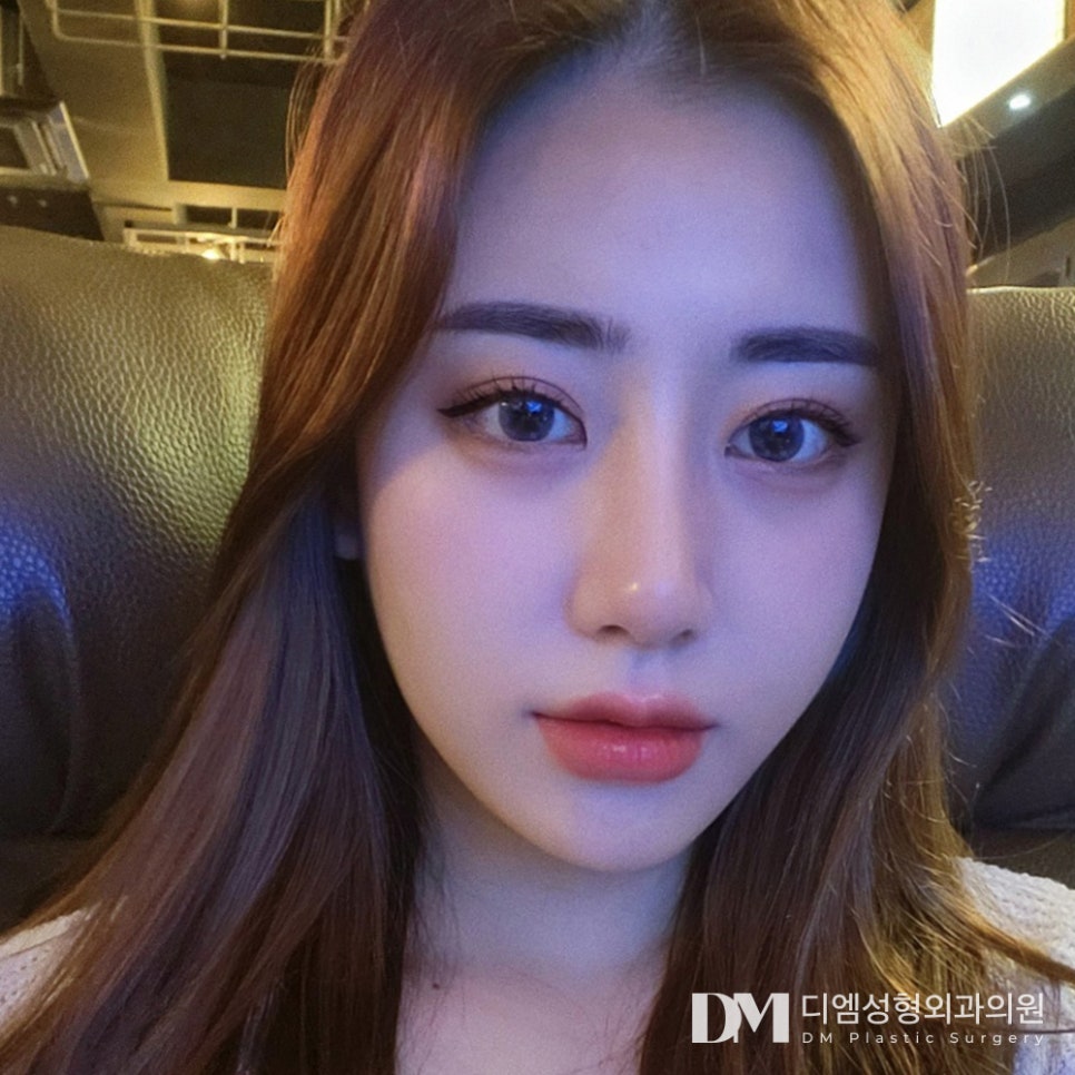 겹주름이 져 피곤한 인상으로 보인다면? 관련 이미지 14