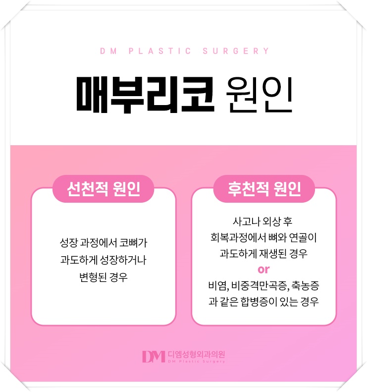 매부리코 , 어느각도에서든 당당한 코 라인으로 관련 이미지 3