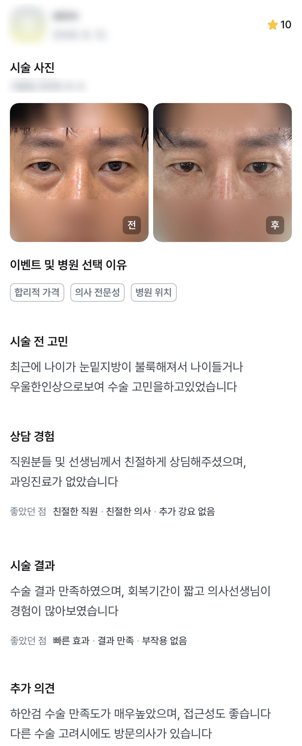 디엠 하안검 수술후기, “하안검 수술 만족도가 매우 높습니다!” 관련 이미지 1