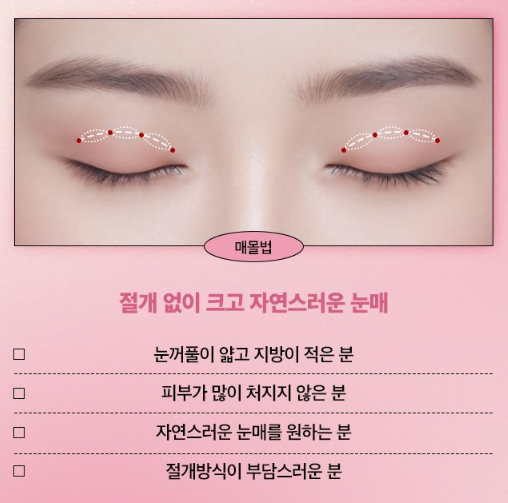 쌍꺼풀수술, 내 눈매에 맞는 자연스러운 라인으로 관련 이미지 7