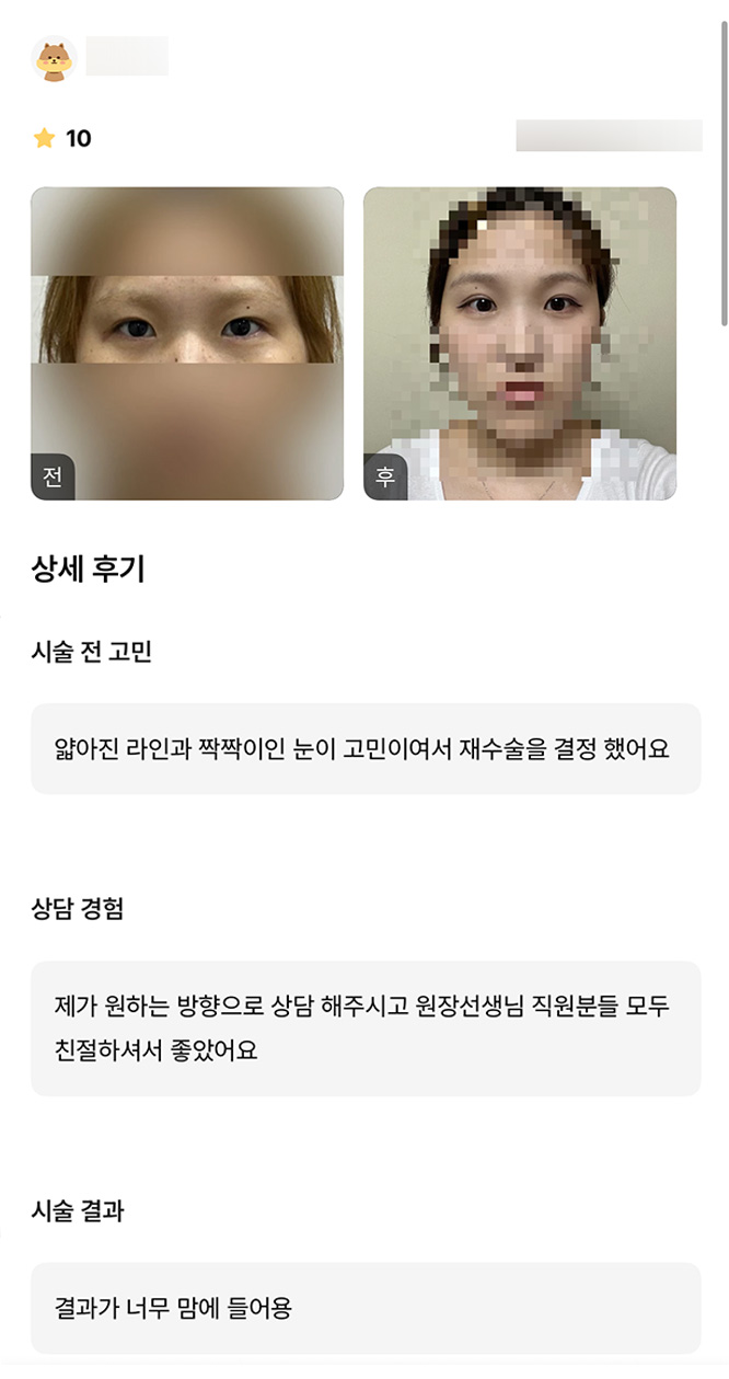 Review of Revision Eye Surgery. "Everyone was so kind, and I’m very happy with the results!" image 1